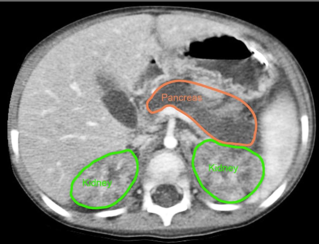 Xray1annotated